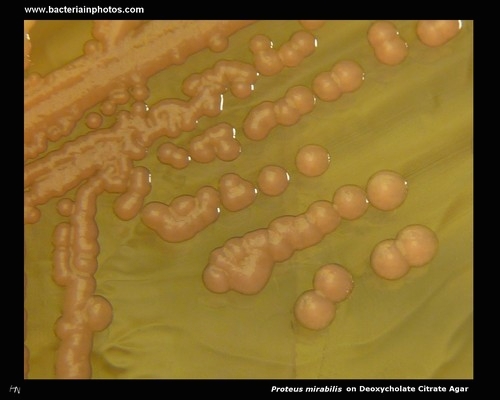proteus on deoxycholate citrate agar